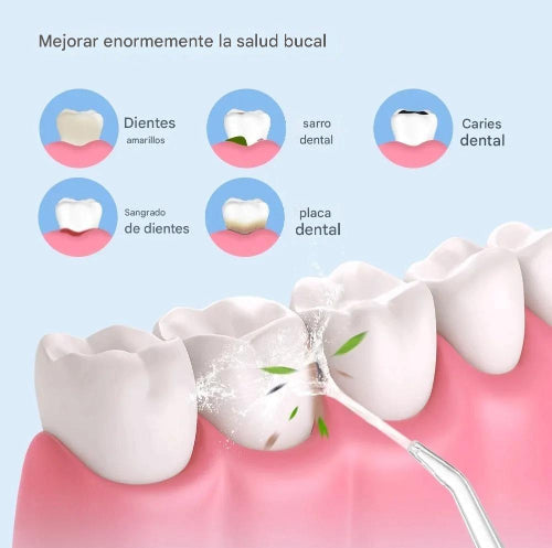 Irrigador Bucal Portátil Limpieza Dental