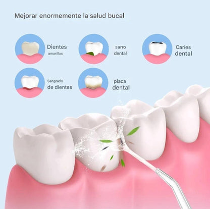 Irrigador Bucal Portátil Limpieza Dental